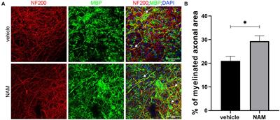 Nicotinamide enhances myelin production after demyelination through reduction of astrogliosis and microgliosis